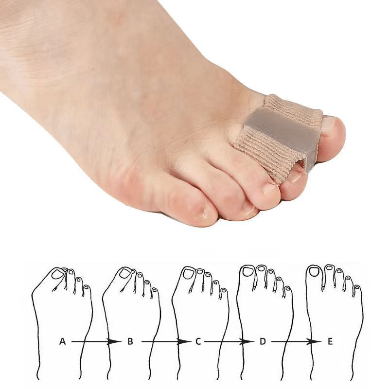 Fiber Toe Separator - Priceless Collect LLC
