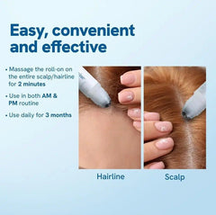 Hair Ball Essence Rosemary Growth Oil - Priceless Collect LLC