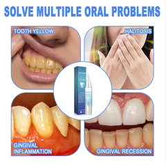 Teeth Repair Gel - Priceless Collect LLC