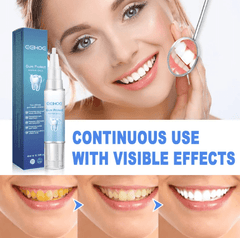 Teeth Repair Gel - Priceless Collect LLC