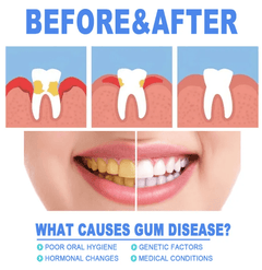 Teeth Repair Gel - Priceless Collect LLC