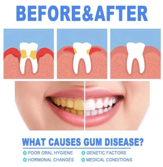 Teeth Repair Gel - Priceless Collect LLC