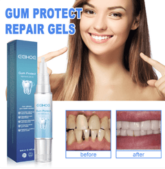 Teeth Repair Gel - Priceless Collect LLC