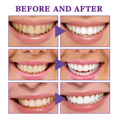 V34 Tooth Cleaning Mousse - Priceless Collect LLC